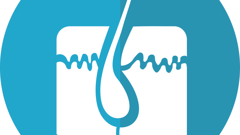 Trapianto di capelli: una soluzione definitiva contro la calvizie